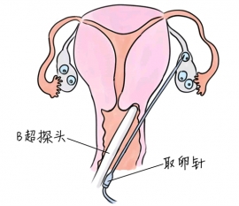 幼儿学画画，兰州捐卵宝宝学画画，学画画的好处，如何学画画